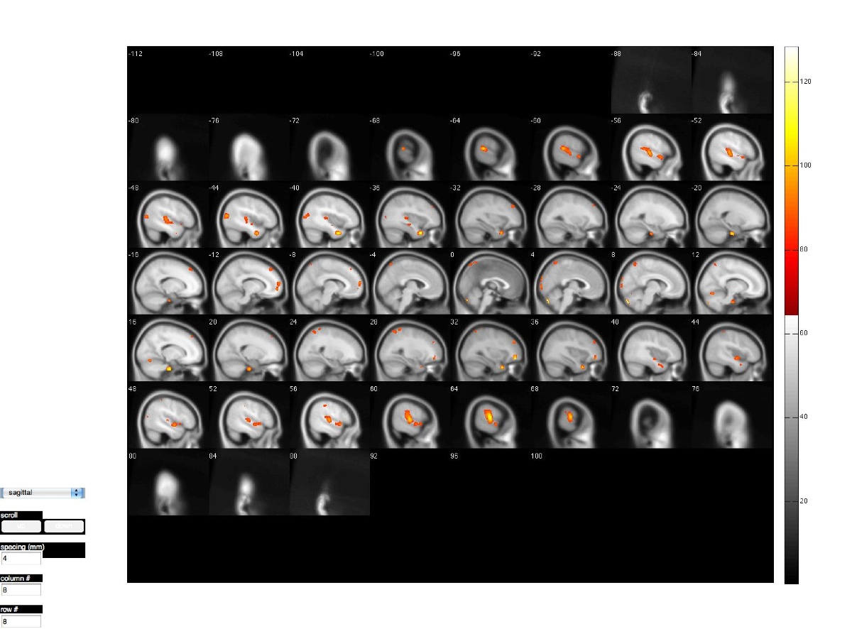 Open Source Brain on Morpholio